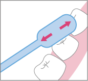 ブラッシングのポイント