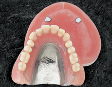 磁性アタッチメント