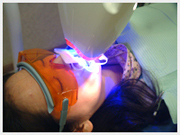 新世代の光照射器「コスモブルー」