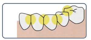 ＰＭＴＣでしか清掃できない所
