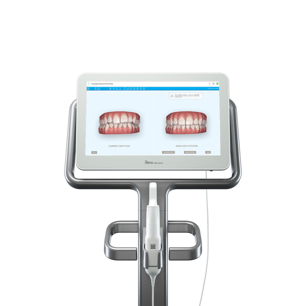 iTero Element2